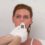 Oral-Heating [+$180.00]