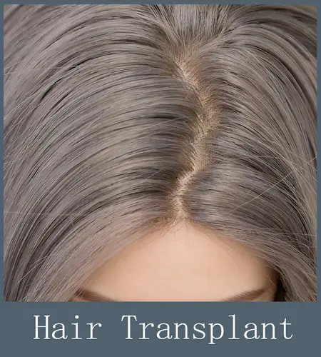 Implanted Artificial Hair [+$100.00]