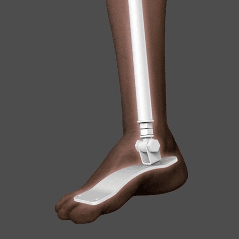 Non toe skeleton