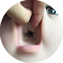 None Teeth
