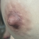 #7
