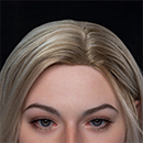 Implanted Synthetic Hair [+$150.00]