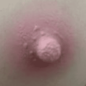 Light Pink