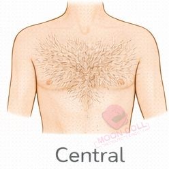 Central [+$50.00]