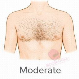 Moderate [+$50.00]