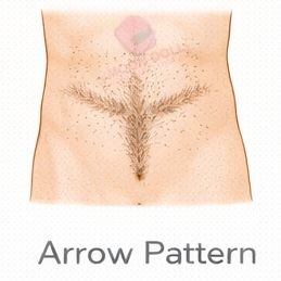 Arrow [+$50.00]