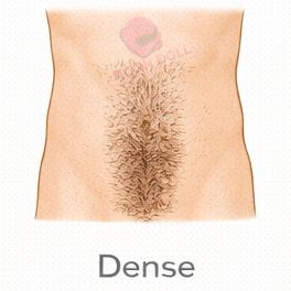 Dense [+$50.00]