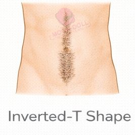 Inverted-T [+$50.00]