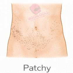 Patchy [+$50.00]