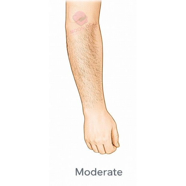 Moderate [+$50.00]