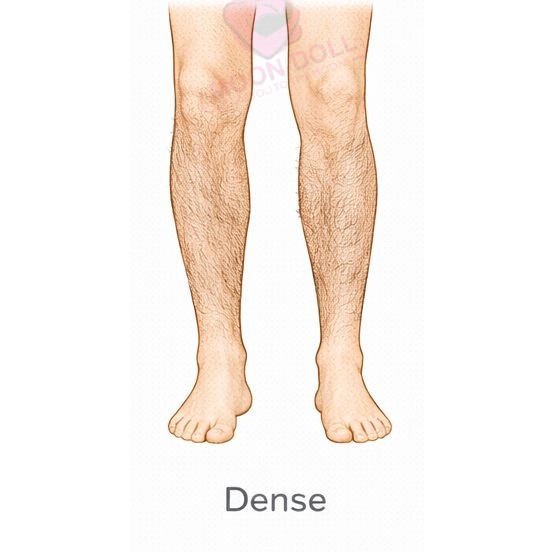Dense [+$70.00]