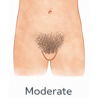 Moderate [+$50.00]
