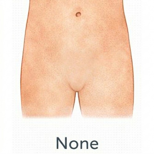 None