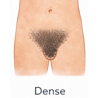 Dense [+$50.00]