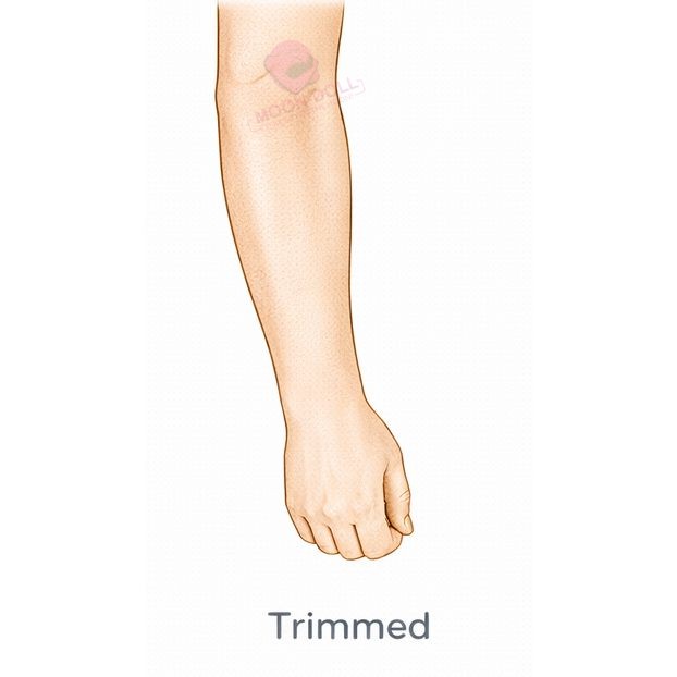Trimmed [+$40.00]