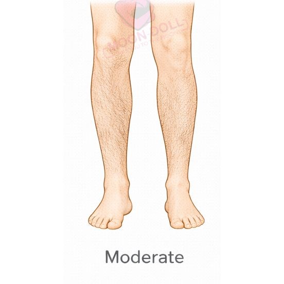Moderate [+$60.00]