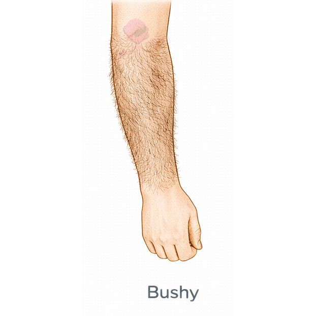 Bushy [+$70.00]