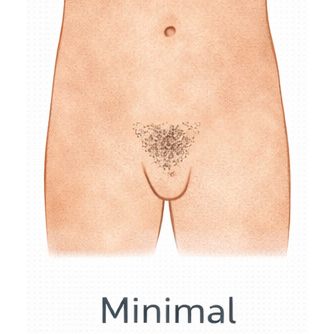 Minimal [+$50.00]