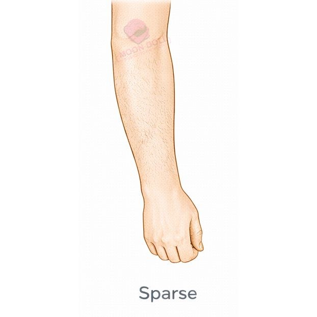 Sparse [+$40.00]
