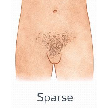 Sparse [+$50.00]