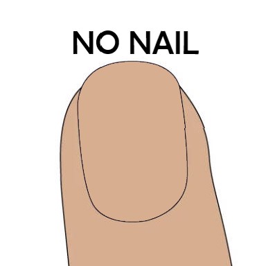 No Nail