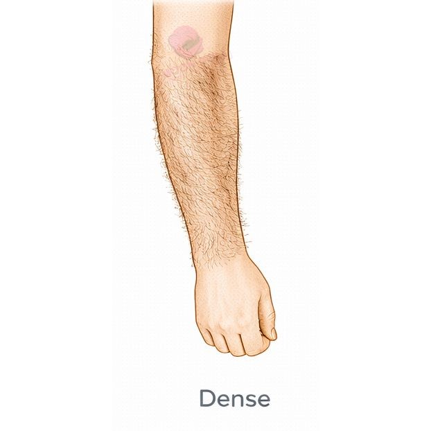 Dense [+$60.00]