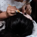 Implanted Hair