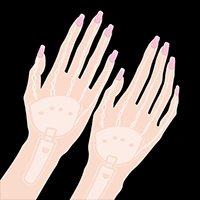 Hard hand