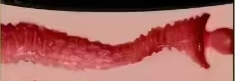 NO.2
