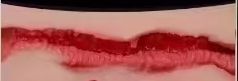 NO.5